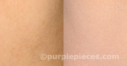 Dr. Jart Black Label BB Cream Review dr jart black label before and after swatches1 Review: Dr. Jart Black Label BB Cream