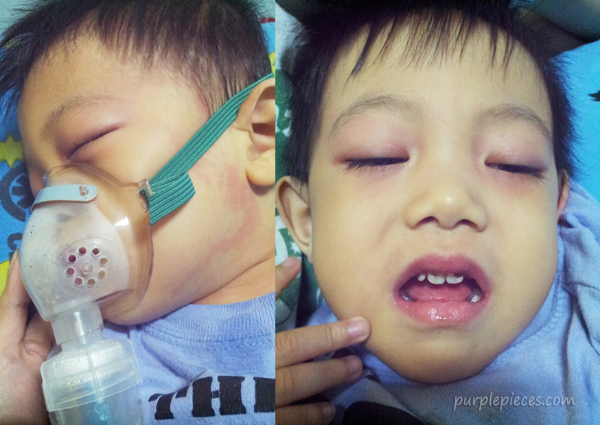 kawasaki-disease-my-son